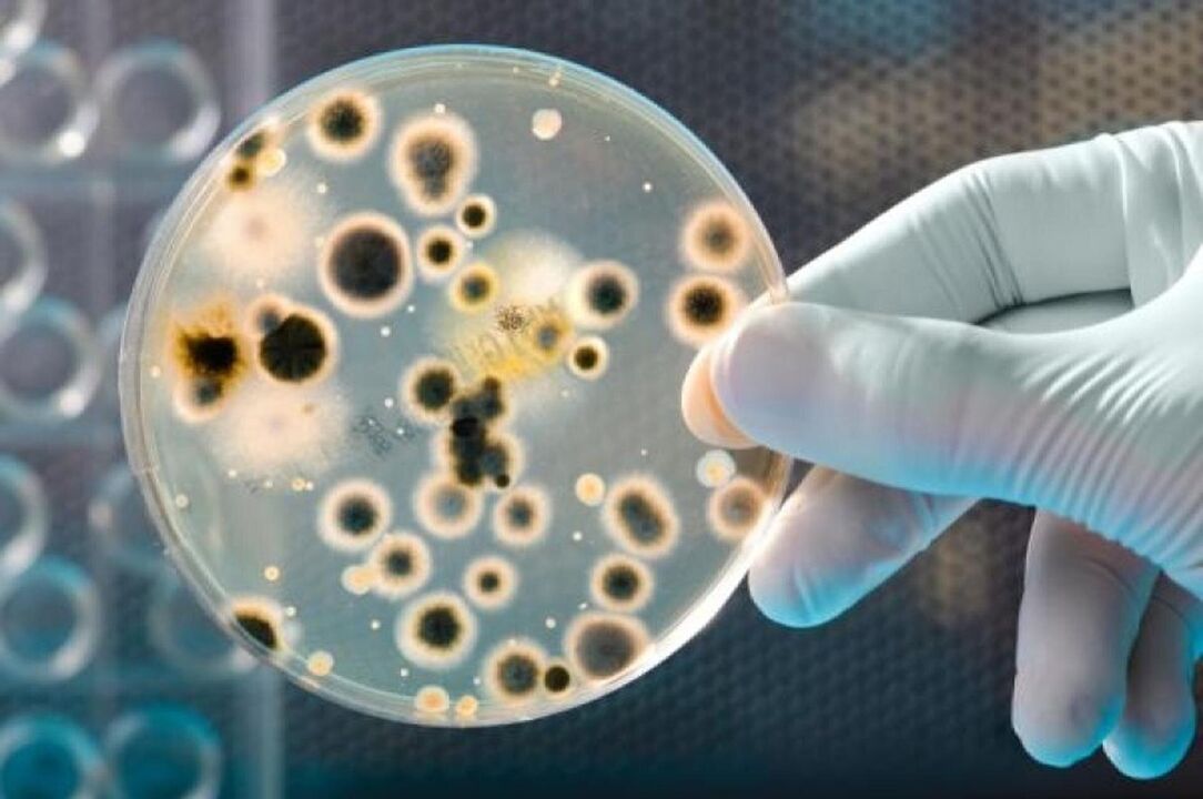 bacteria causing infectious prostatitis